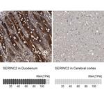 SERC2 Antibody in Immunohistochemistry (IHC)