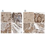 MRPS22 Antibody in Immunohistochemistry (IHC)