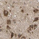 MRPS22 Antibody in Immunohistochemistry (IHC)