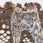 MRPS22 Antibody in Immunohistochemistry (IHC)