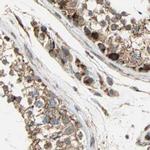 MRPS22 Antibody in Immunohistochemistry (IHC)