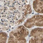 MRPS22 Antibody in Immunohistochemistry (IHC)