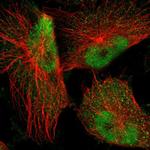 NFIA Antibody in Immunocytochemistry (ICC/IF)