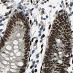 NFIA Antibody in Immunohistochemistry (IHC)