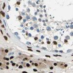 NFIA Antibody in Immunohistochemistry (IHC)