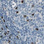 NFIA Antibody in Immunohistochemistry (IHC)