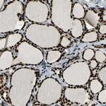 NFIA Antibody in Immunohistochemistry (IHC)