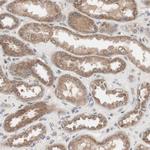 HMBS Antibody in Immunohistochemistry (IHC)