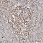 PDZK1 Antibody in Immunohistochemistry (IHC)