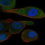 PDZK1 Antibody in Immunocytochemistry (ICC/IF)