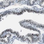 AJUBA Antibody in Immunohistochemistry (Paraffin) (IHC (P))