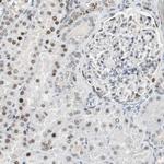 AJUBA Antibody in Immunohistochemistry (Paraffin) (IHC (P))