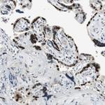 AJUBA Antibody in Immunohistochemistry (Paraffin) (IHC (P))