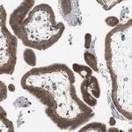 ADAMTSL4 Antibody in Immunohistochemistry (Paraffin) (IHC (P))