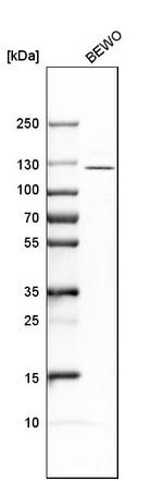 ADAMTSL4 Antibody in Western Blot (WB)