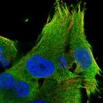 LZTS1 Antibody in Immunocytochemistry (ICC/IF)