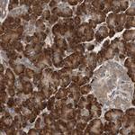 LZTS1 Antibody in Immunohistochemistry (Paraffin) (IHC (P))