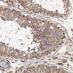 LZTS1 Antibody in Immunohistochemistry (Paraffin) (IHC (P))