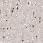 Cdc5L Antibody in Immunohistochemistry (Paraffin) (IHC (P))