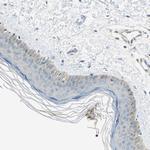 DDAH1 Antibody in Immunohistochemistry (Paraffin) (IHC (P))