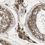 DDAH1 Antibody in Immunohistochemistry (Paraffin) (IHC (P))