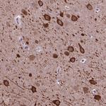 PIAS3 Antibody in Immunohistochemistry (Paraffin) (IHC (P))