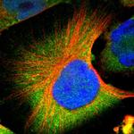 CNOT3 Antibody in Immunocytochemistry (ICC/IF)