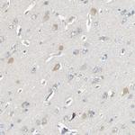 RAPGEF1 Antibody in Immunohistochemistry (Paraffin) (IHC (P))