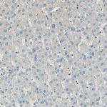 RAPGEF1 Antibody in Immunohistochemistry (Paraffin) (IHC (P))