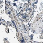 RAPGEF1 Antibody in Immunohistochemistry (Paraffin) (IHC (P))