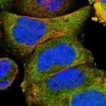 Adenylate Kinase 1 Antibody in Immunocytochemistry (ICC/IF)