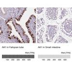 Adenylate Kinase 1 Antibody