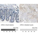 Carboxypeptidase A3 Antibody in Immunohistochemistry (IHC)