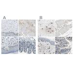 Carboxypeptidase A3 Antibody in Immunohistochemistry (IHC)