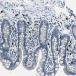 Carboxypeptidase A3 Antibody in Immunohistochemistry (IHC)