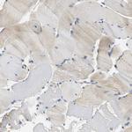 Carboxypeptidase A3 Antibody in Immunohistochemistry (IHC)