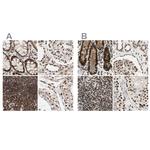 CHAMP1 Antibody in Immunohistochemistry (IHC)