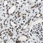 BCLAF1 Antibody in Immunohistochemistry (IHC)