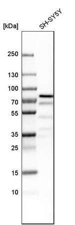 ZKSCAN1 Antibody in Western Blot (WB)