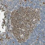 RAD18 Antibody in Immunohistochemistry (Paraffin) (IHC (P))