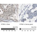 PITRM1 Antibody