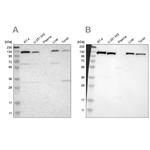 PITRM1 Antibody in Western Blot (WB)