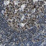 USP28 Antibody in Immunohistochemistry (IHC)