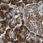 USP28 Antibody in Immunohistochemistry (IHC)