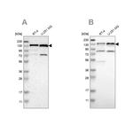 USP28 Antibody in Western Blot (WB)