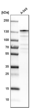 USP28 Antibody in Western Blot (WB)