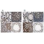 USP28 Antibody in Immunohistochemistry (IHC)