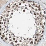 USP28 Antibody in Immunohistochemistry (IHC)