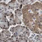 USP28 Antibody in Immunohistochemistry (IHC)