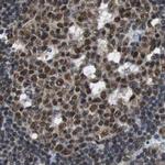 USP28 Antibody in Immunohistochemistry (IHC)